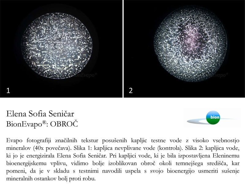 energetska terapija